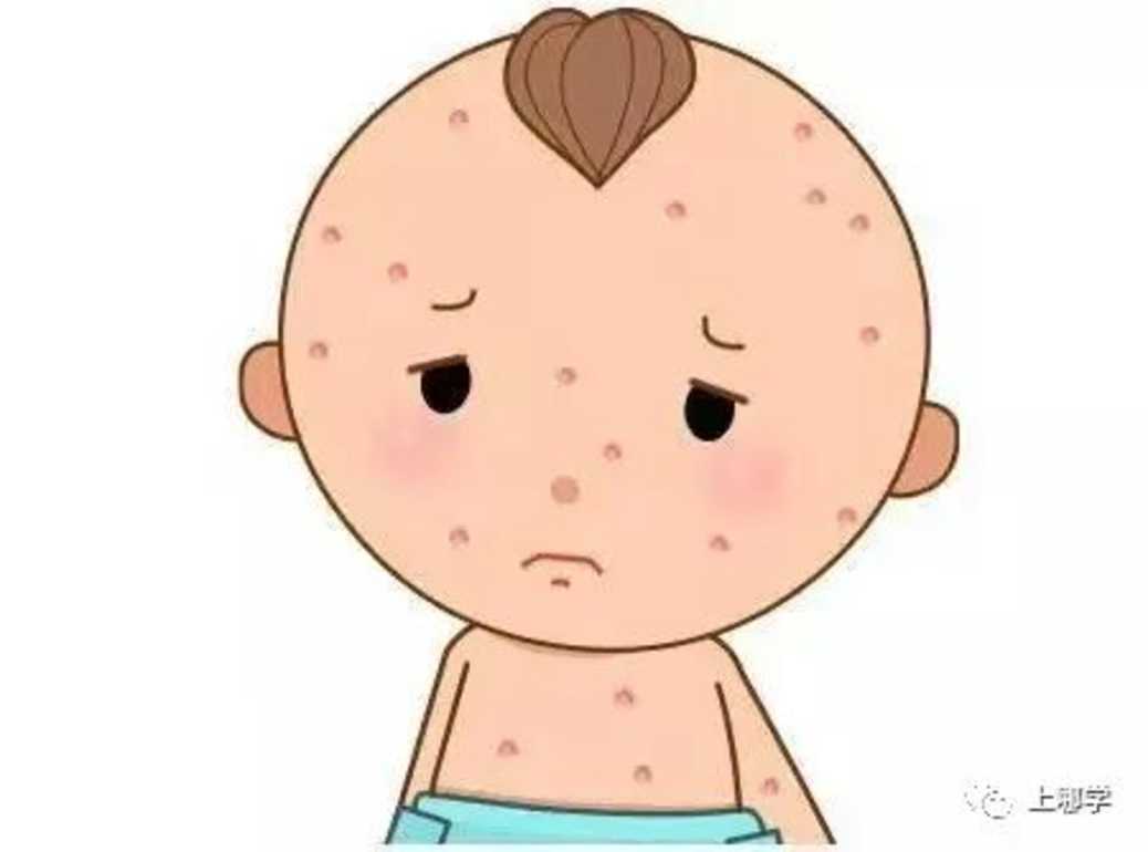 幼儿易中招！这6种春季传染病已进入高发期！家长需警惕！症状与新冠相似，别弄混！相关资料 10