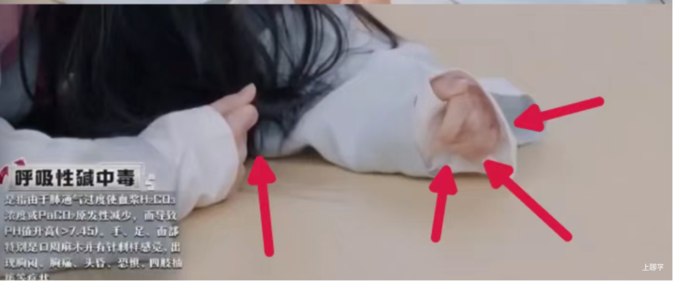 11岁男孩因赶作业致“中毒”！成年人也会发病！医生紧急提醒：严重可致命！相关资料 4
