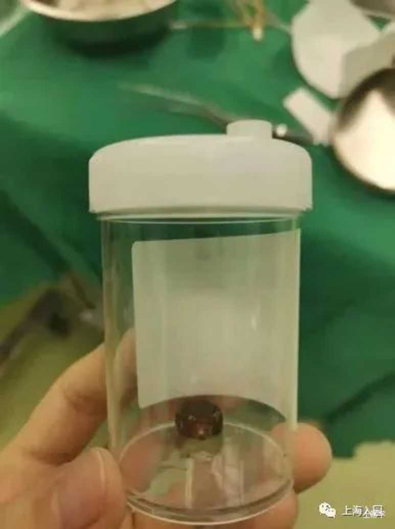 4岁女童鼻腔塞入异物鼻血不止，家里孩子出现同情况，第一时间应这样做！相关资料