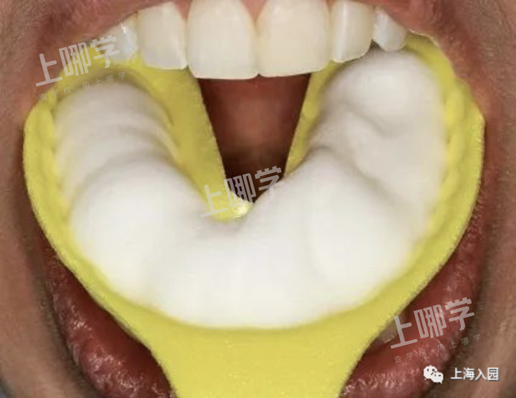 3岁开始每年2次！这件事情上海家长一定要重视！部分学校也会统一组织！相关资料 3