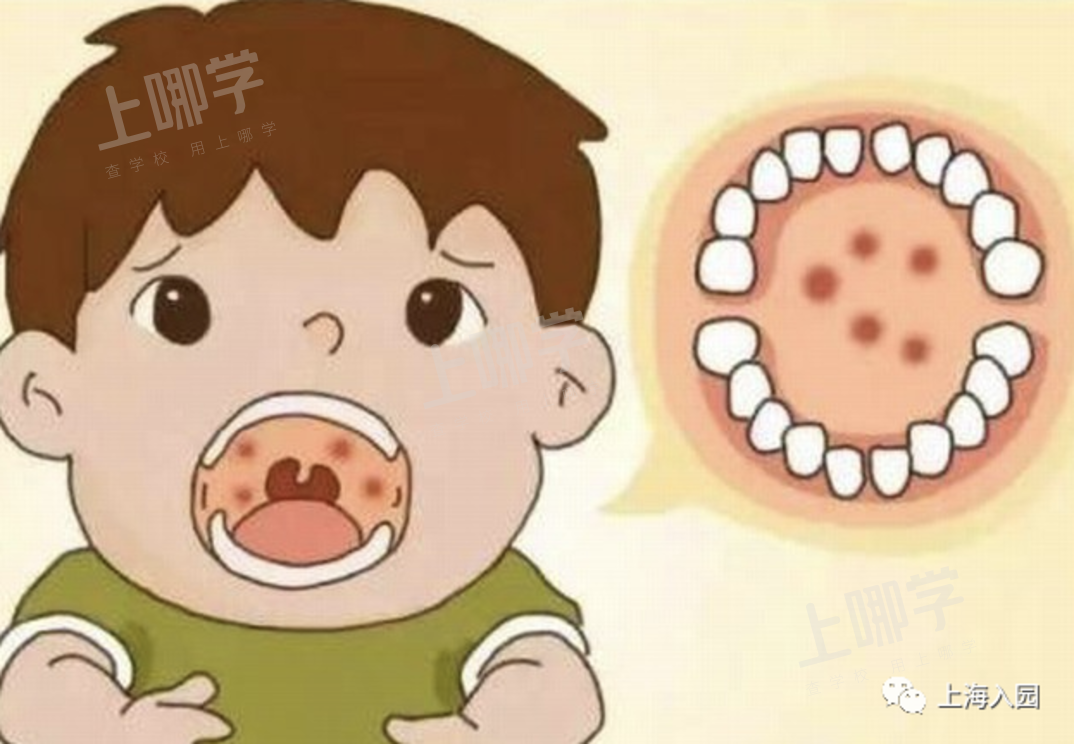 儿童医院爆满？秋冬3大病毒来袭，不少儿童已中招！家长越早预防越好！相关资料 3