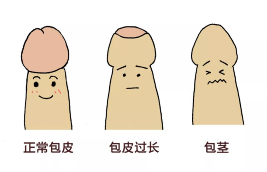 对话从业26年男科主任医师：不是每个包皮都要挨一刀！相关资料 3
